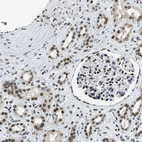 Immunohistochemical staining of human kidney shows strong nuclear positivity in cells in glomeruli and cells in tubules.