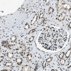 Immunohistochemical staining of human kidney shows strong nuclear positivity in cells in glomeruli and cells in tubules.