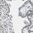 Immunohistochemical staining of human placenta shows strong nuclear positivity in trophoblastic cells and decidual cells.