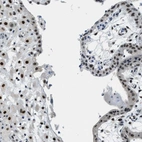 Immunohistochemical staining of human placenta shows strong nuclear positivity in trophoblastic cells and decidual cells.