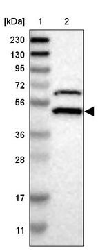 Lane 1: Marker [kDa] 230, 130, 95, 72, 56, 36, 28, 17, 11_br/_Lane 2: Human cell line RT-4
