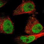 Immunofluorescent staining of human cell line U-251 MG shows localization to nucleoplasm.