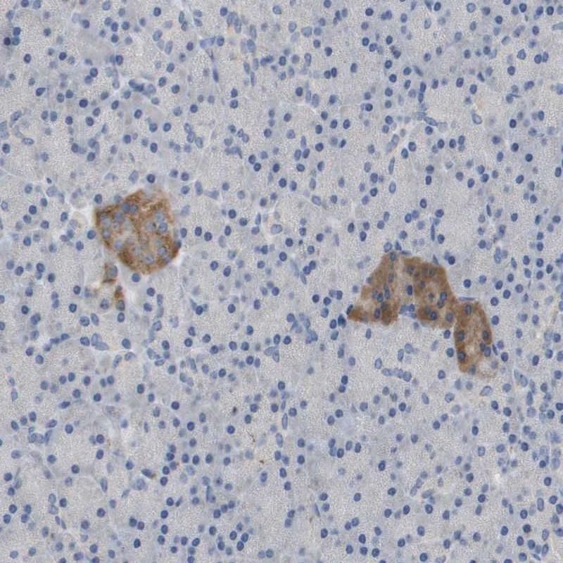 Anti-FNDC9 Antibody