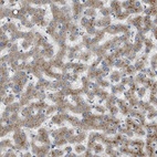 Anti-B3GNT5 Antibody