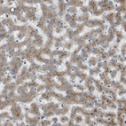 Anti-B3GNT5 Antibody