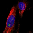 Immunofluorescent staining of human cell line U-251 MG shows localization to nucleoli.
