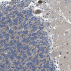 Anti-SCN4B Antibody