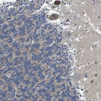 Immunohistochemical staining of human cerebellum shows moderate cytoplasmic positivity in purkinje cells.