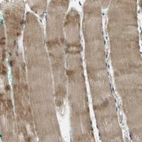 Immunohistochemical staining of human skeletal muscle shows moderate cytoplasmic positivity in myocytes.