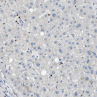 Immunohistochemical staining of human liver shows no positivity in hepatocytes as expected.