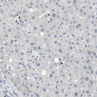 Immunohistochemical staining of human liver shows no positivity in hepatocytes as expected.