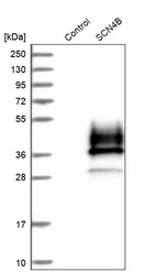 Western blot analysis in control (vector only transfected HEK293T lysate) and SCN4B over-expression lysate (Co-expressed with a C-terminal myc-DDK tag (~3.1 kDa) in mammalian HEK293T cells, LY406238).