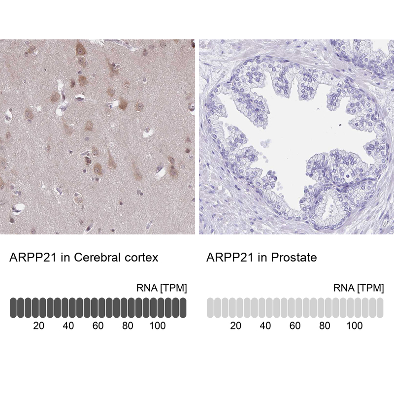 Anti-ARPP21 Antibody
