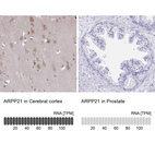 Anti-ARPP21 Antibody