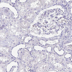 Immunohistochemical staining of human kidney shows no positivity in cells in tubules as expected.