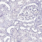 Immunohistochemical staining of human kidney shows no positivity in cells in tubules as expected.