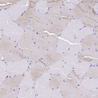 Immunohistochemical staining of human skeletal muscle shows very weak cytoplasmic positivity in myocytes.