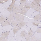 Immunohistochemical staining of human skeletal muscle shows very weak cytoplasmic positivity in myocytes.