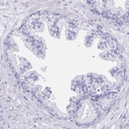 Immunohistochemical staining of human prostate shows no positivity in glandular cells as expected.