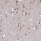 Immunohistochemical staining of human cerebral cortex shows weak cytoplasmic positivity in neurons.