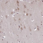 Immunohistochemical staining of human cerebral cortex shows weak cytoplasmic positivity in neurons.