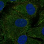 Immunofluorescent staining of human cell line A549 shows localization to plasma membrane.