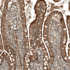 Immunohistochemical staining of human small intestine shows membranous/cytoplasmic positivity in glandular cells.