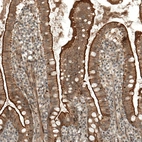 Immunohistochemical staining of human small intestine shows membranous/cytoplasmic positivity in glandular cells.