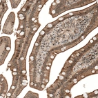 Immunohistochemical staining of human duodenum shows membranous/cytoplasmic positivity in glandular cells.