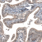 Immunohistochemical staining of human fallopian tube shows moderate membranous/cytoplasmic positivity in glandular cells.