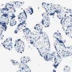 Immunohistochemical staining of human placenta shows no positivity in trophoblastic cells as expected.