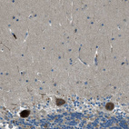 Immunohistochemical staining of human cerebellum shows strong cytoplasmic positivity in Purkinje cells.