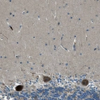 Immunohistochemical staining of human cerebellum shows strong cytoplasmic positivity in Purkinje cells.