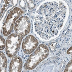 Immunohistochemical staining of human kidney shows moderate cytoplasmic positivity in cells in tubules.