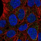 Immunofluorescent staining of human cell line RT4 shows localization to peroxisomes.