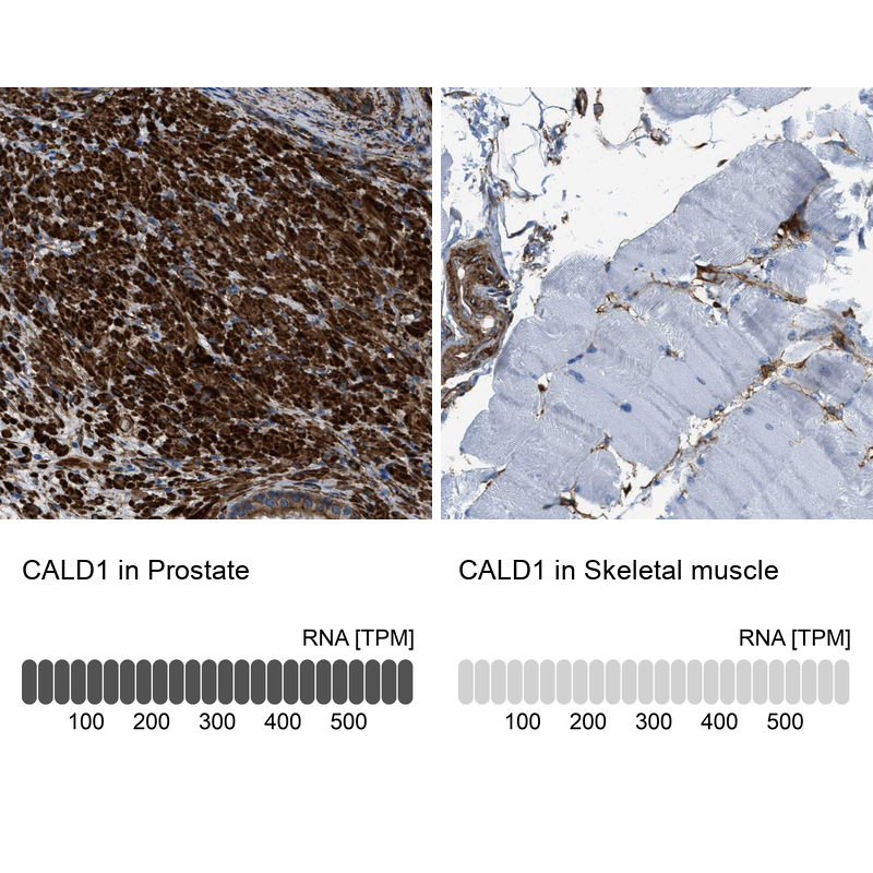 Anti-CALD1 Antibody
