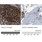 Anti-CALD1 Antibody
