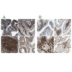 Immunohistochemical staining of human fallopian tube, gastrointestinal, prostate and testis using Anti-CALD1 antibody HPA017330 (A) shows similar protein distribution across tissues to independent antibody HPA008066 (B).