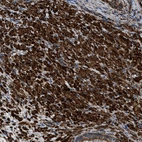 Immunohistochemical staining of human prostate shows strong cytoplasmic positivity in smooth muscle cells.