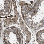 Immunohistochemical staining of human testis shows strong cytoplasmic positivity in peritubular myoid cells.