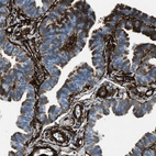 Immunohistochemical staining of human fallopian tube shows strong cytoplasmic positivity in smooth muscle cells.