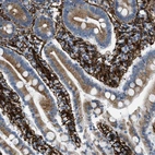 Immunohistochemical staining of human duodenum shows strong cytoplasmic positivity in smooth muscle cells.