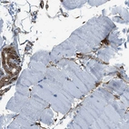 Immunohistochemical staining of human skeletal muscle shows moderate cytoplasmic positivity in smooth muscle cells.