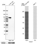 Western blot analysis in human cell lines U-251MG and MCF-7 using Anti-CALD1 antibody. Corresponding CALD1 RNA-seq data are presented for the same cell lines. Loading control: Anti-GAPDH.