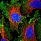Immunofluorescent staining of human cell line U-2 OS shows localization to plasma membrane & actin filaments.