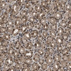 Anti-RBM5 Antibody