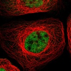 Immunofluorescent staining of human cell line A-431 shows localization to nucleoplasm.