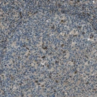 Immunohistochemical staining of human lymph node shows moderate to strong positivity in nuclear membrane in a subset of germinal center cells.