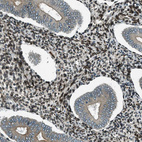 Immunohistochemical staining of human endometrium shows moderate to strong positivity in nuclear membrane in stromal cells.