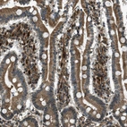 Immunohistochemical staining of human duodenum shows moderate to strong positivity in nuclear membrane in lymphoid cells.